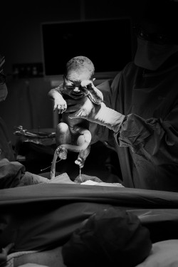 Townsville Birth Photography